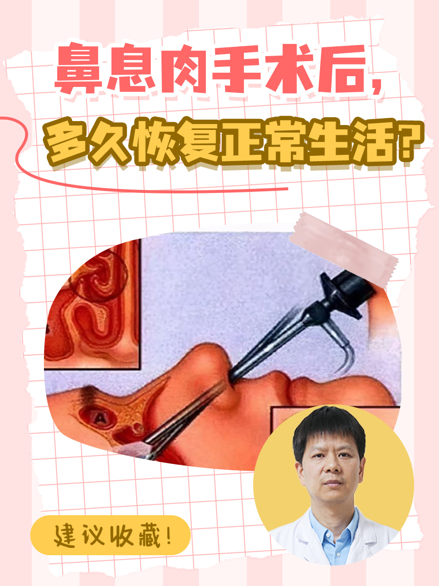 鼻息肉能自愈吗