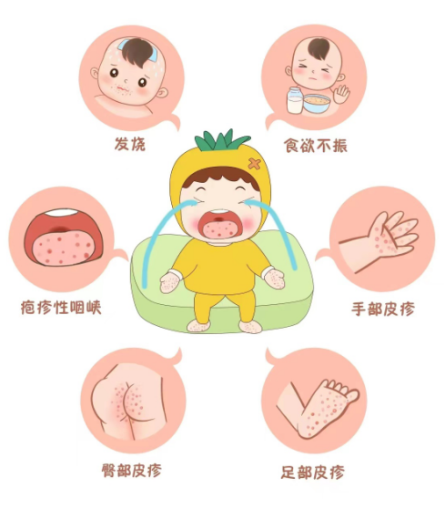 手足口病的传播途径是什么