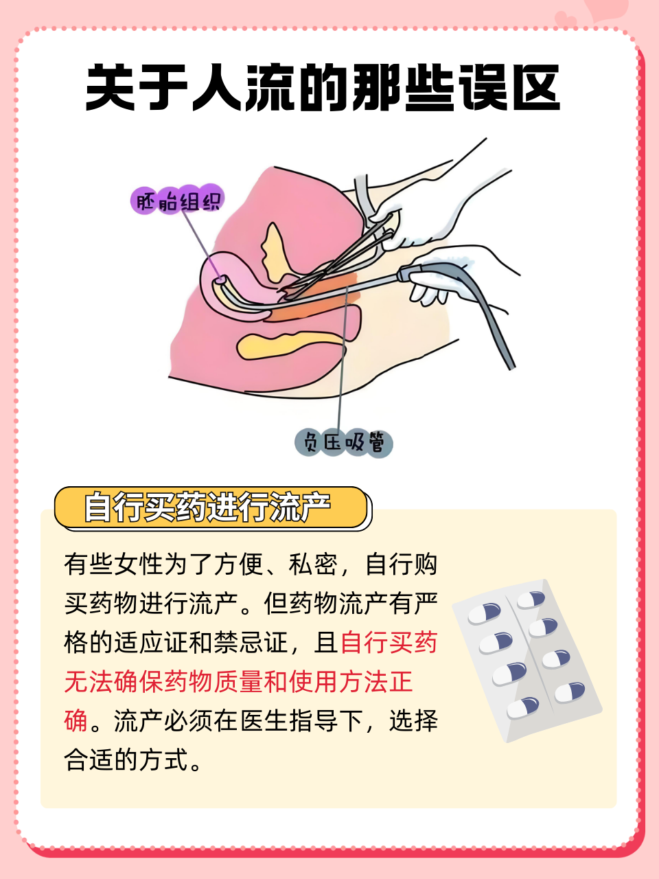 普通人流怎么做