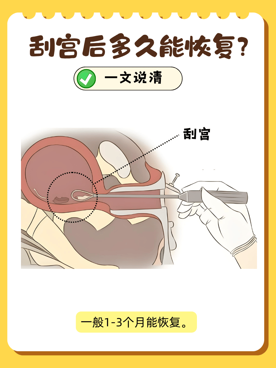 怀孕多久可以去做人流?