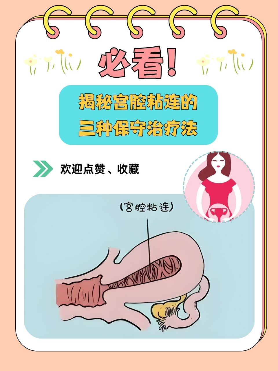 宫腔粘连手术多少钱