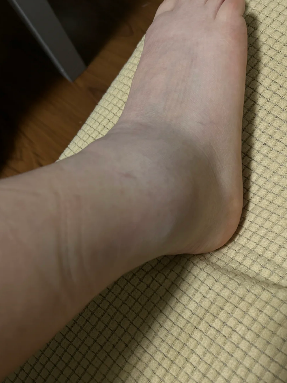 脚扭伤多长时间能恢复