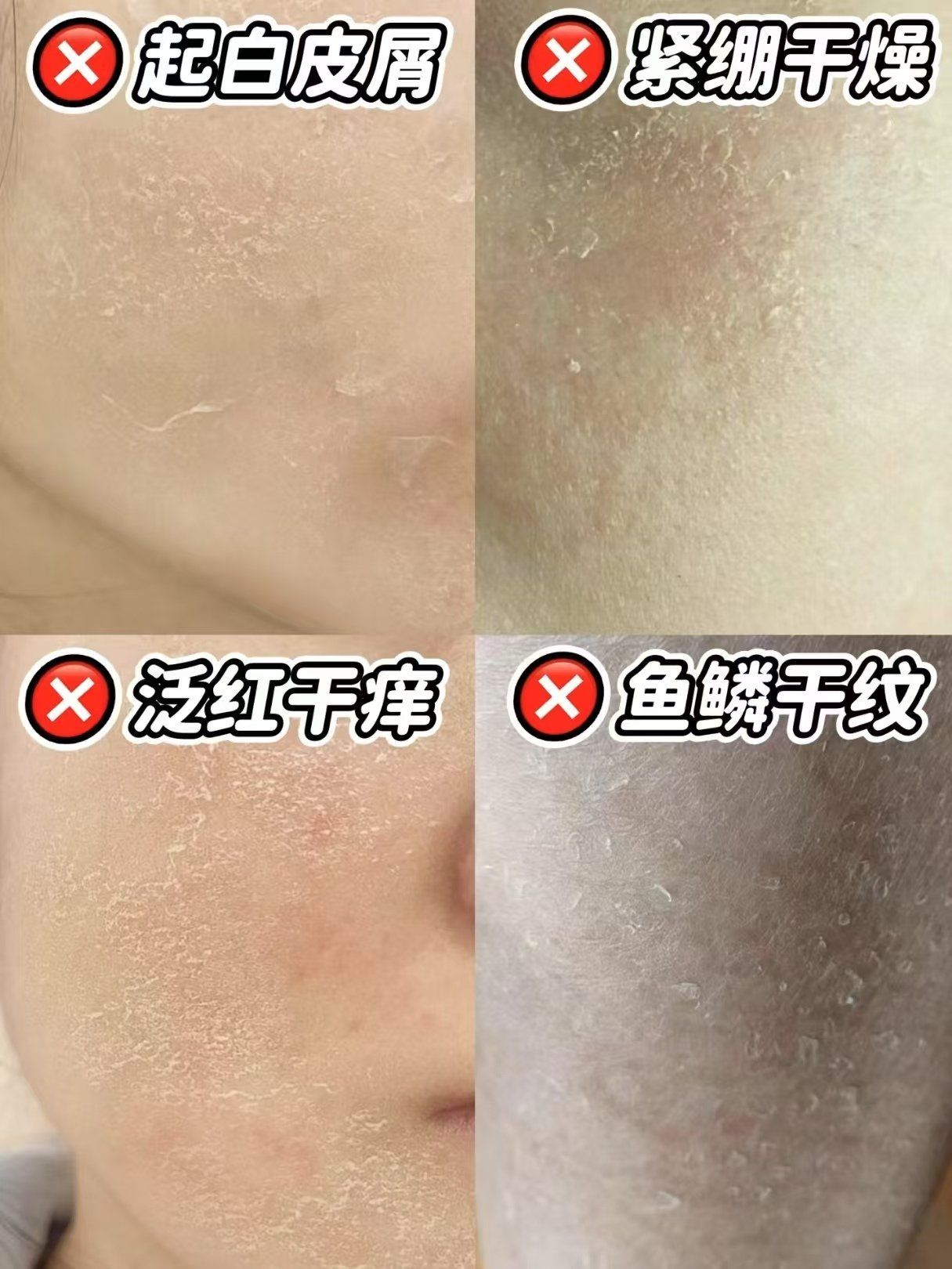 脸上起干皮怎么办