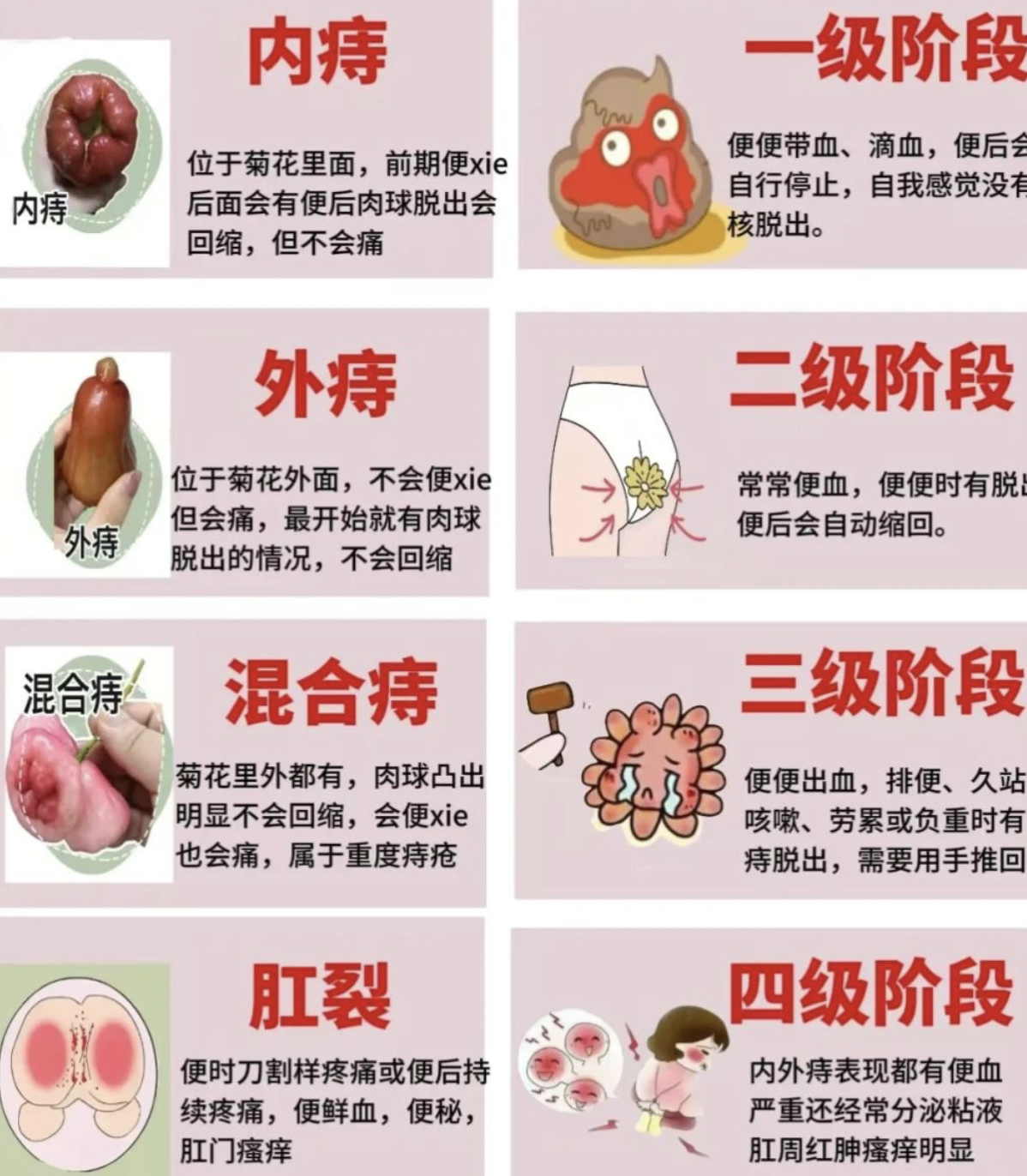 肛门疼痛是什么原因引起的