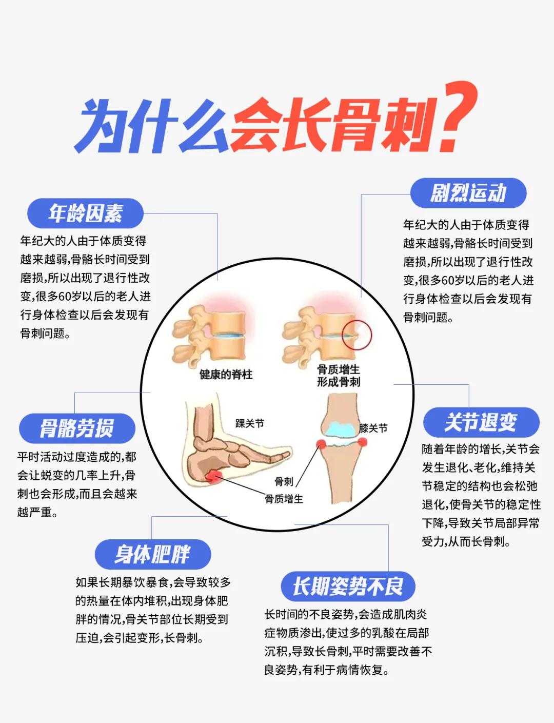 治疗骨刺的偏方