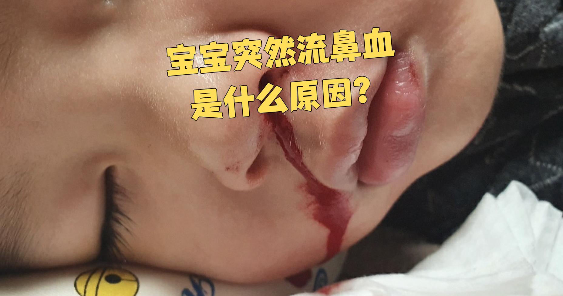 3岁宝宝流鼻血是什么原因?