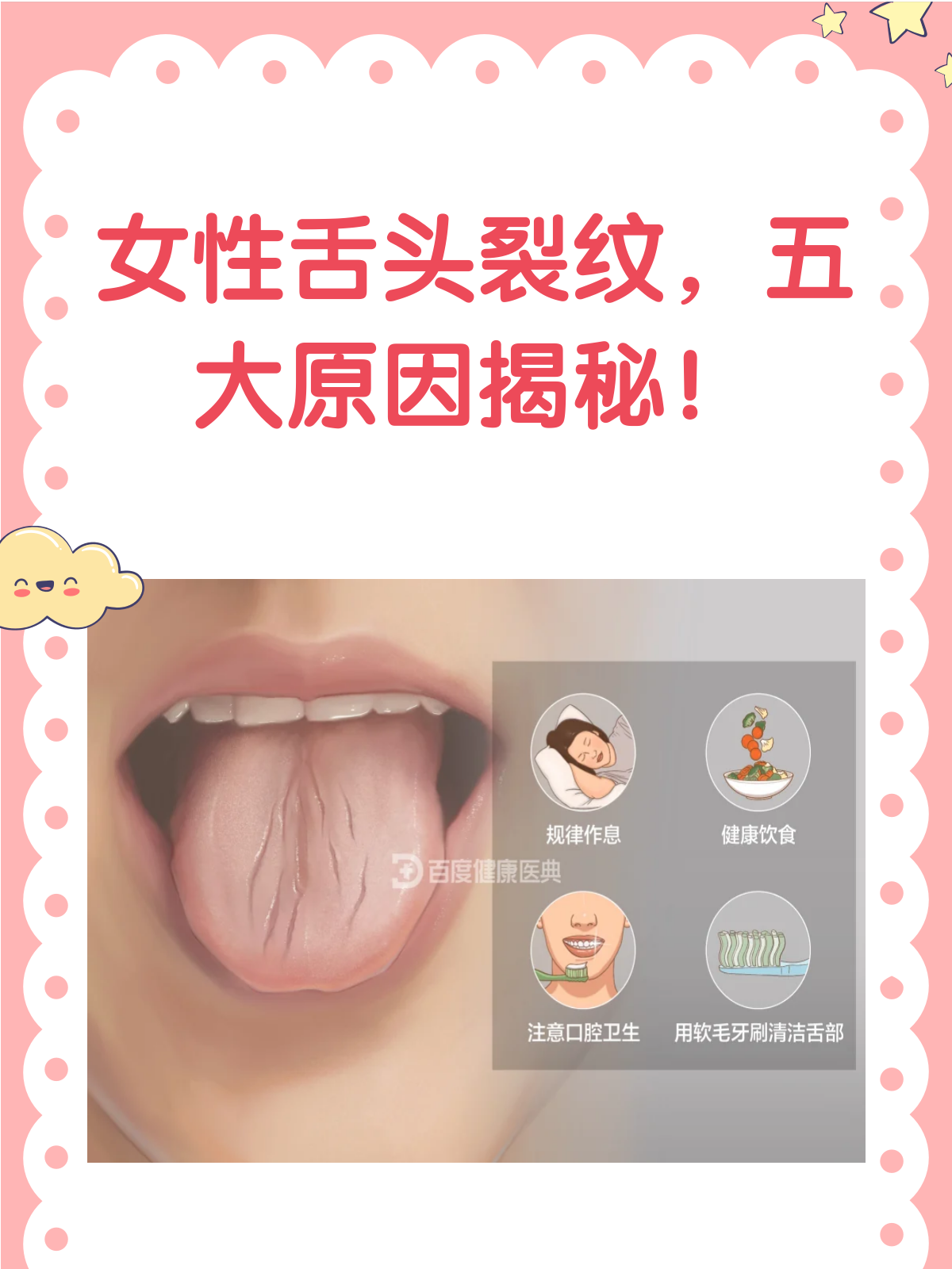 舌头上有裂缝是什么病?