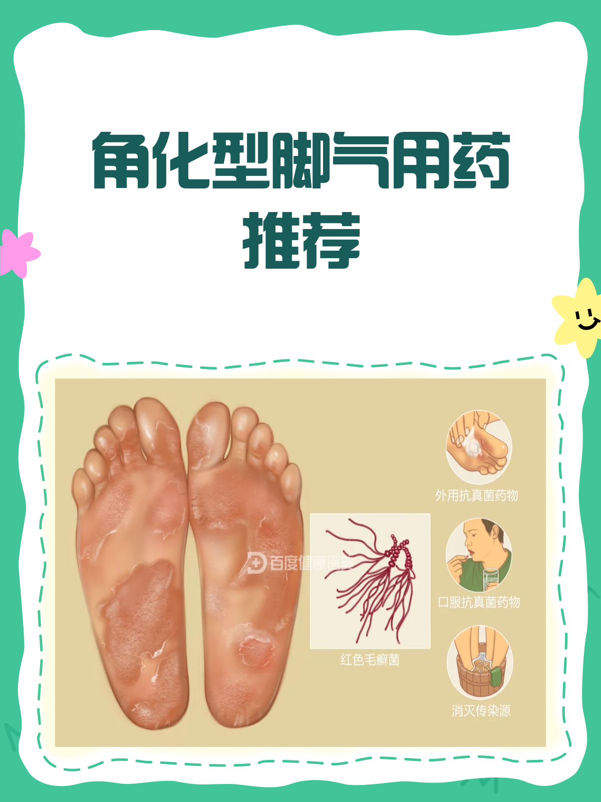 孕妇脚气严重怎么办