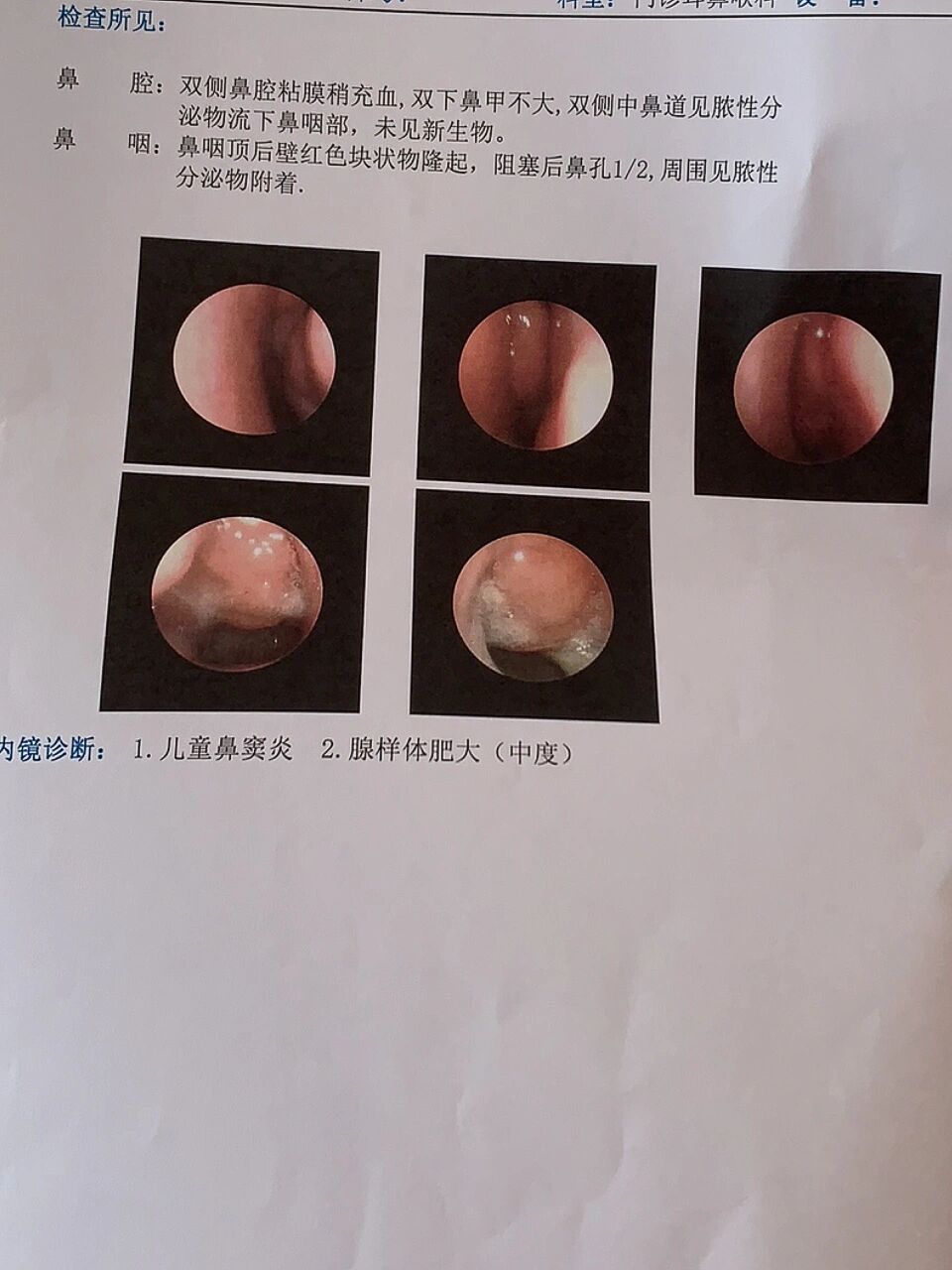 鼻镜检查多少钱