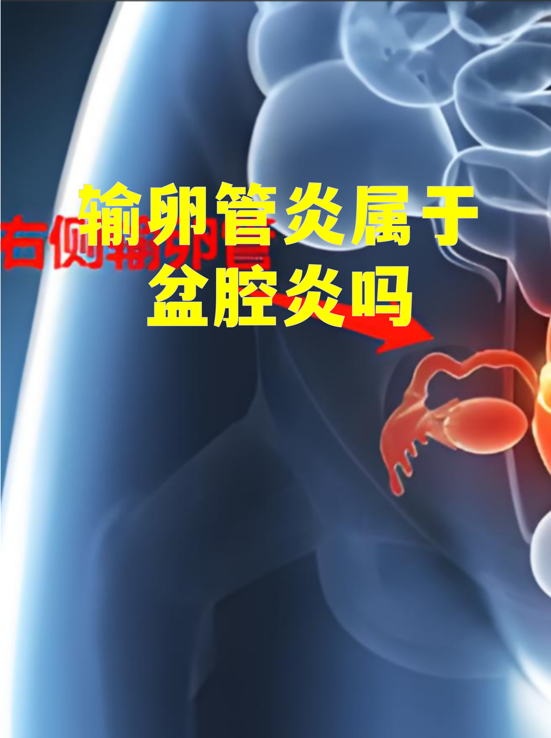 卵巢炎是怎么引起的