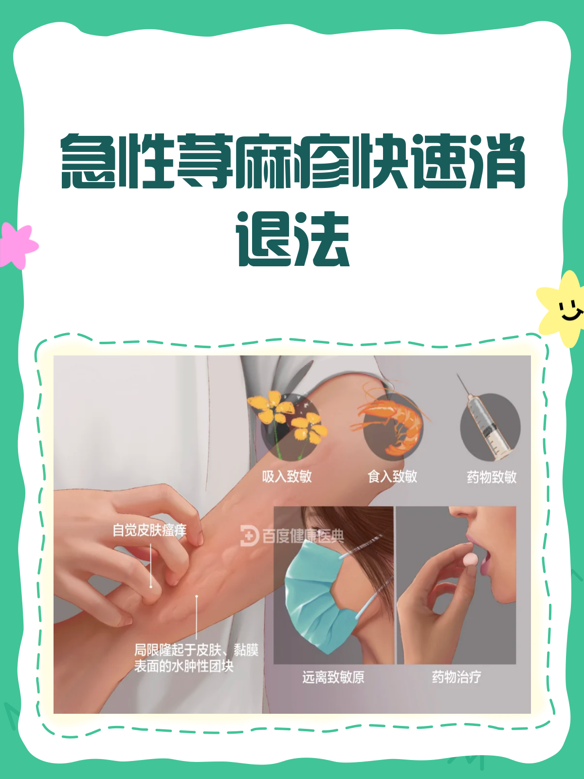 荨麻疹最佳治疗方法是什么