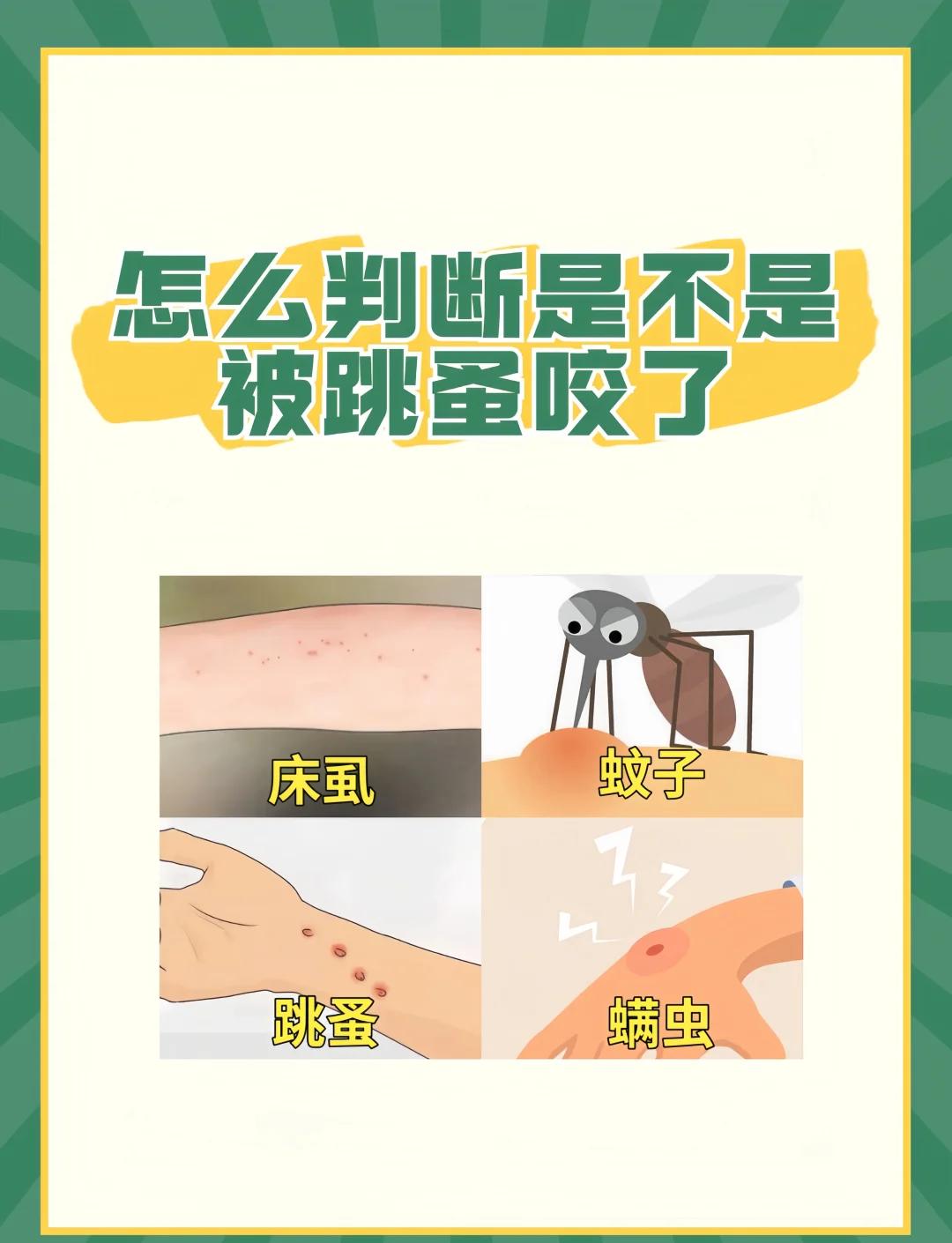 被跳蚤咬了怎么办?