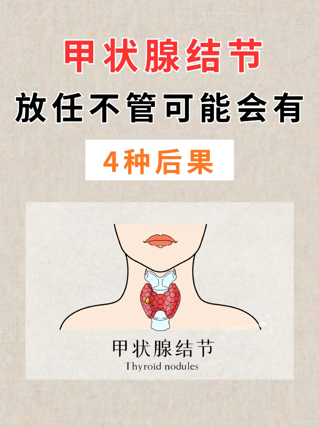 甲状腺囊肿如何治疗?