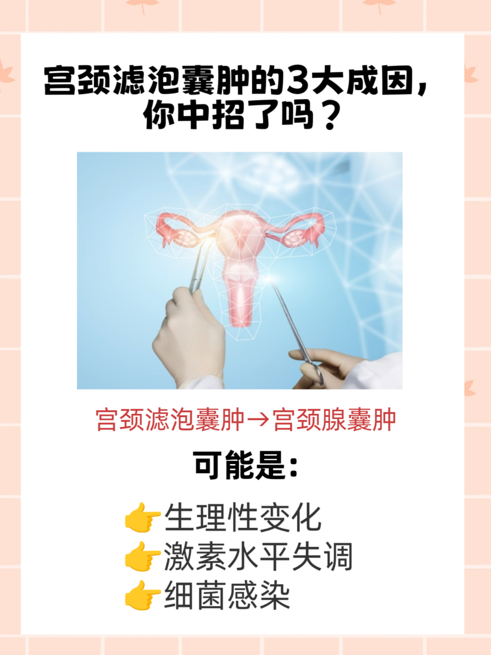 宫颈囊肿怎么治疗