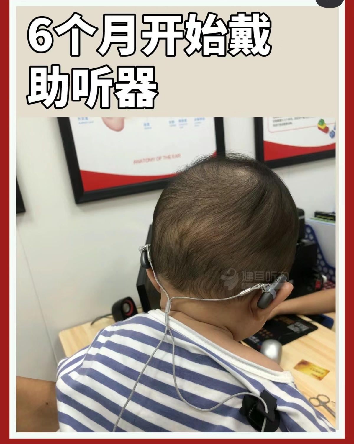 什么是新生儿听力筛查?