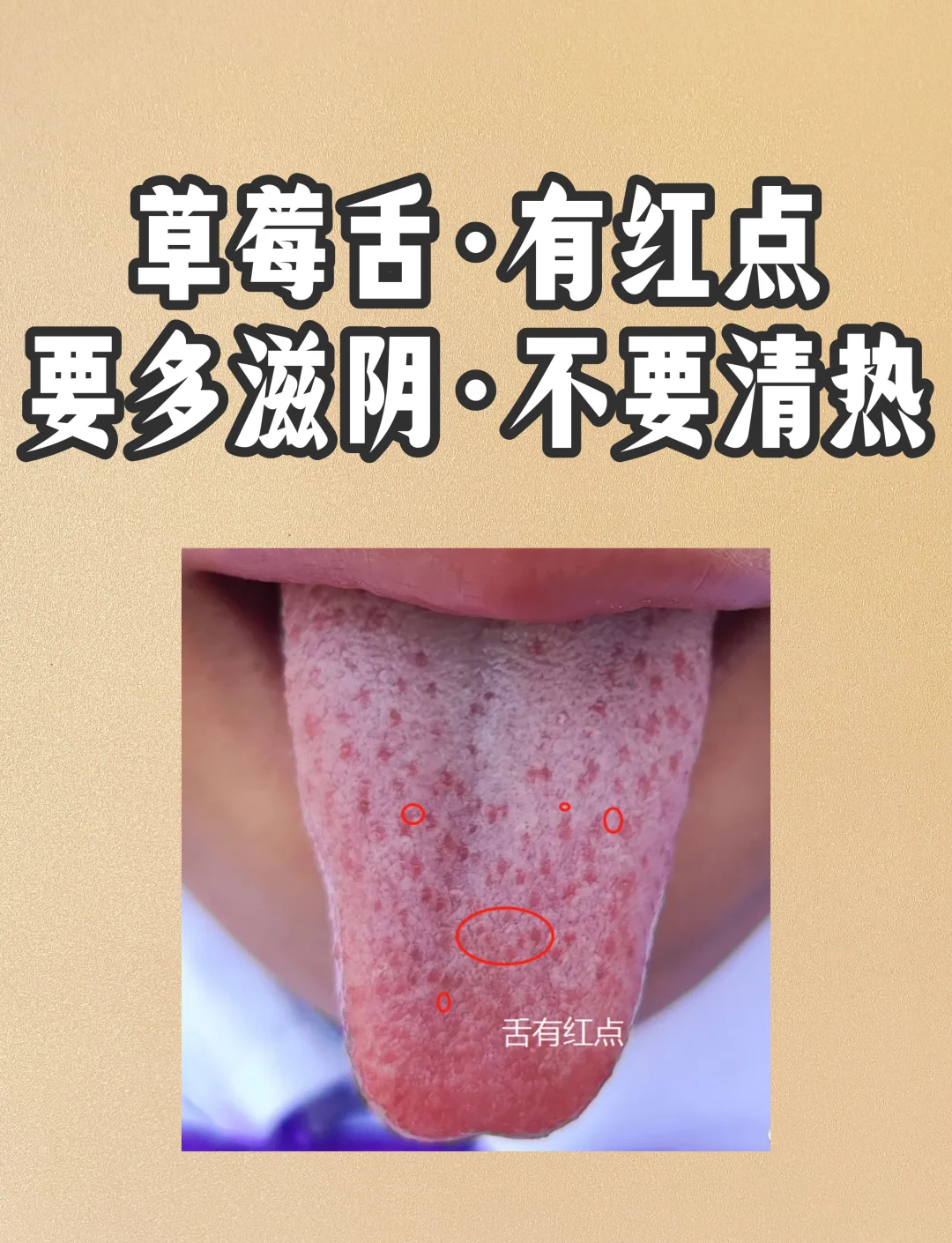 草莓吃多了会上火吗