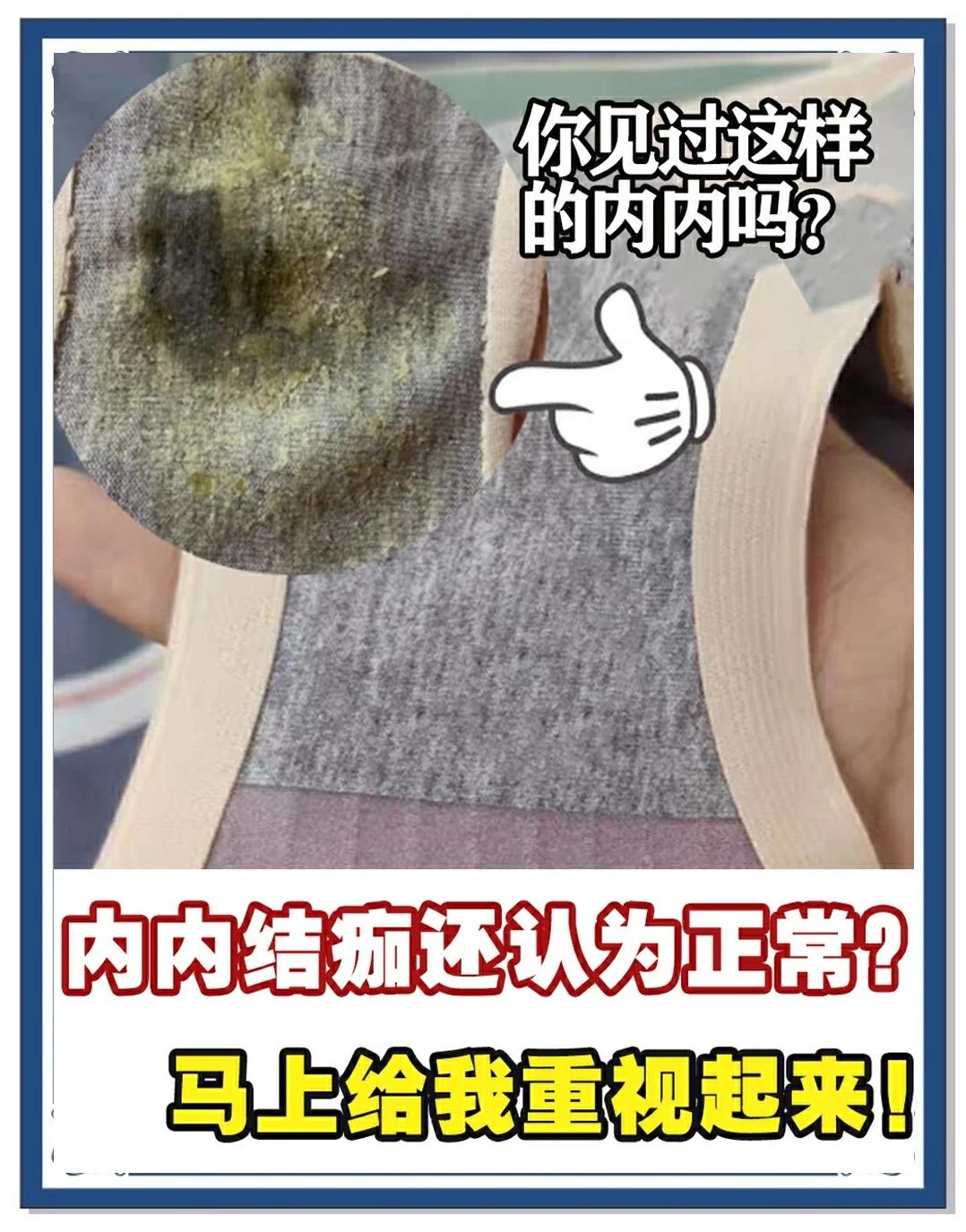 内裤发黄是什么原因引起的