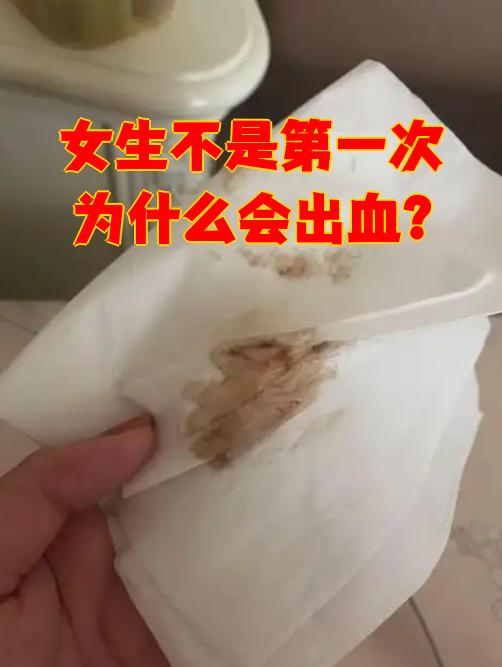 第一次会不会出血?