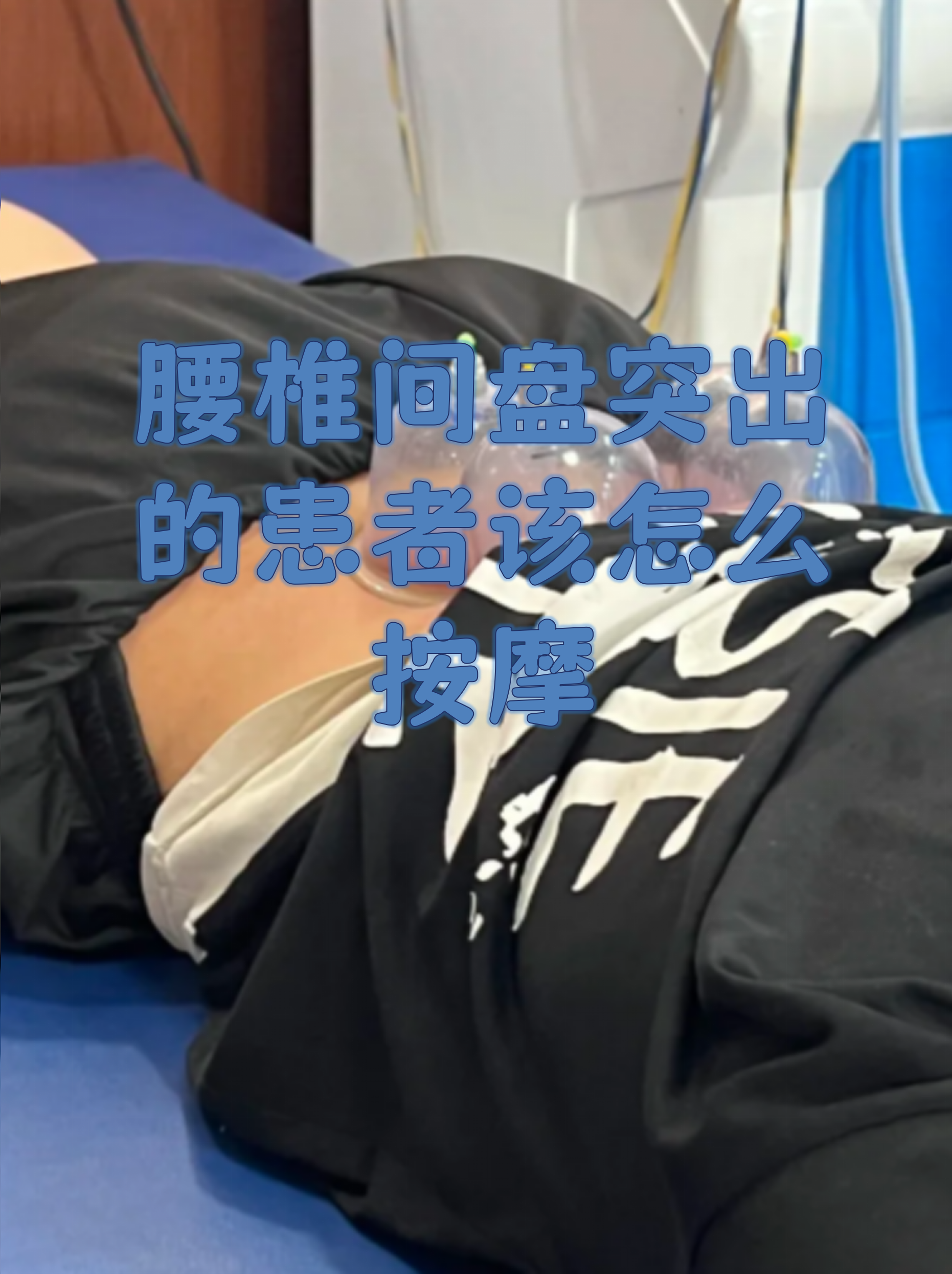 腰椎骨质增生的治疗方法