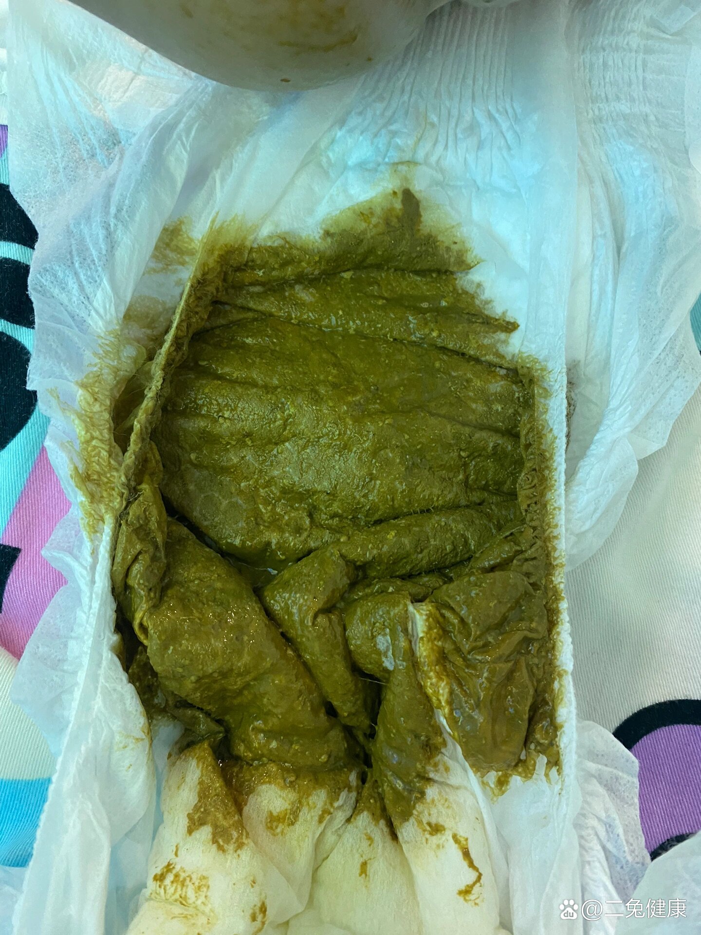 拉绿色大便是怎么回事?