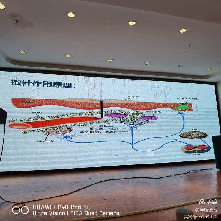 小儿疳积的治疗