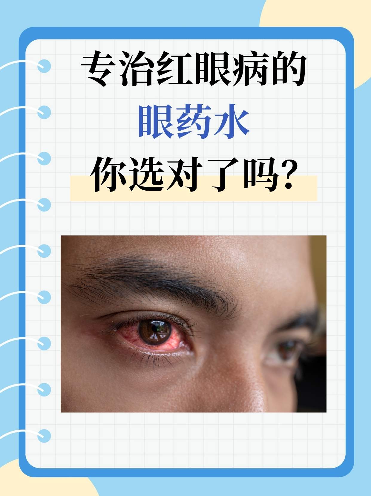 结膜炎是由什么引起的?