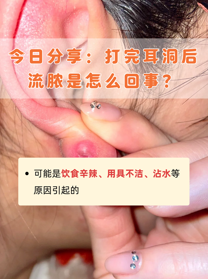 打完耳洞后的注意事项