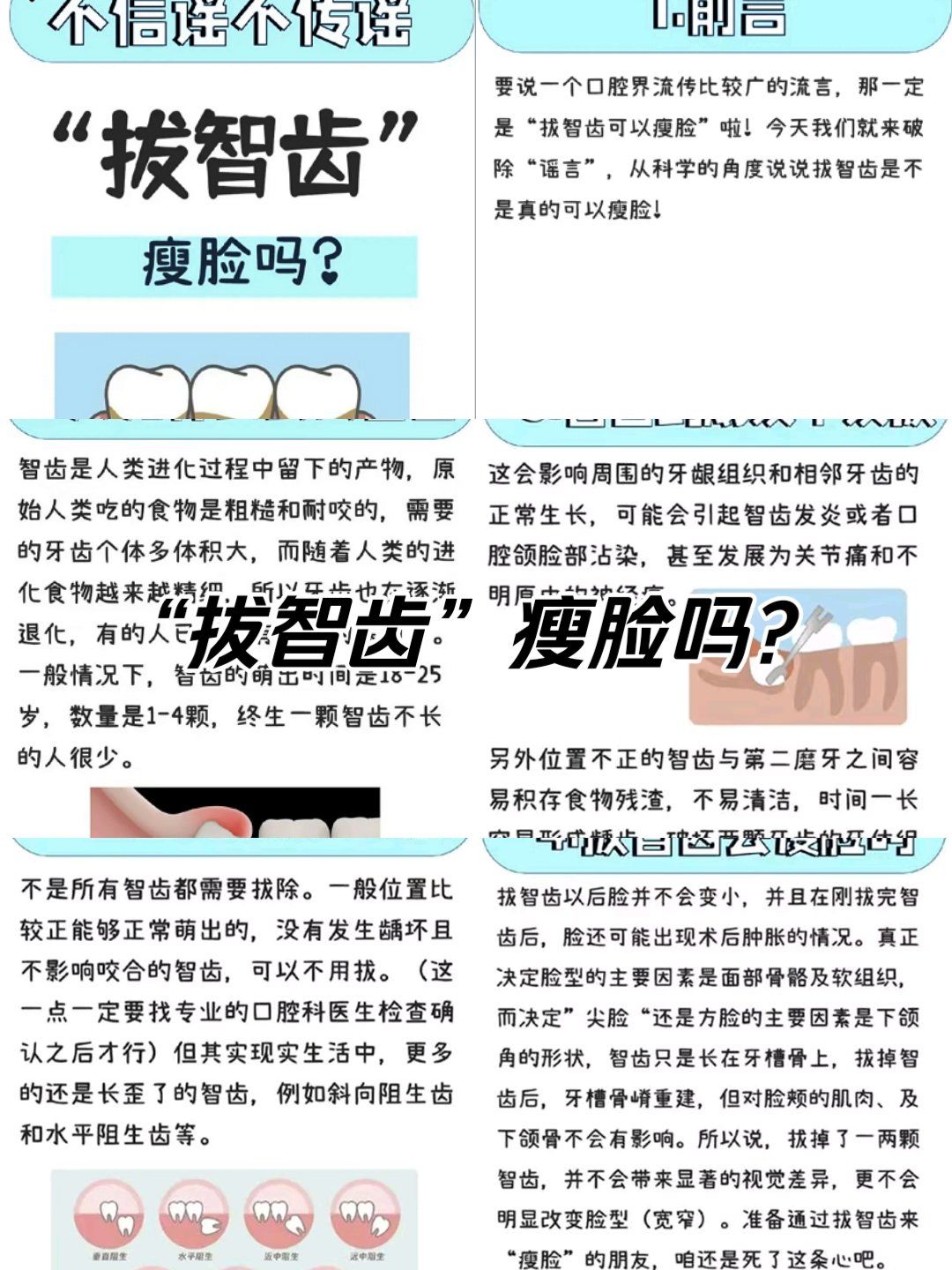 拔智齿脸会变小吗