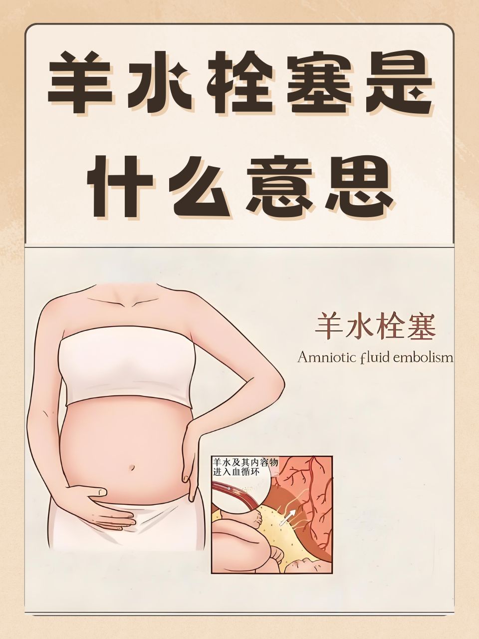 羊水漏了是什么症状