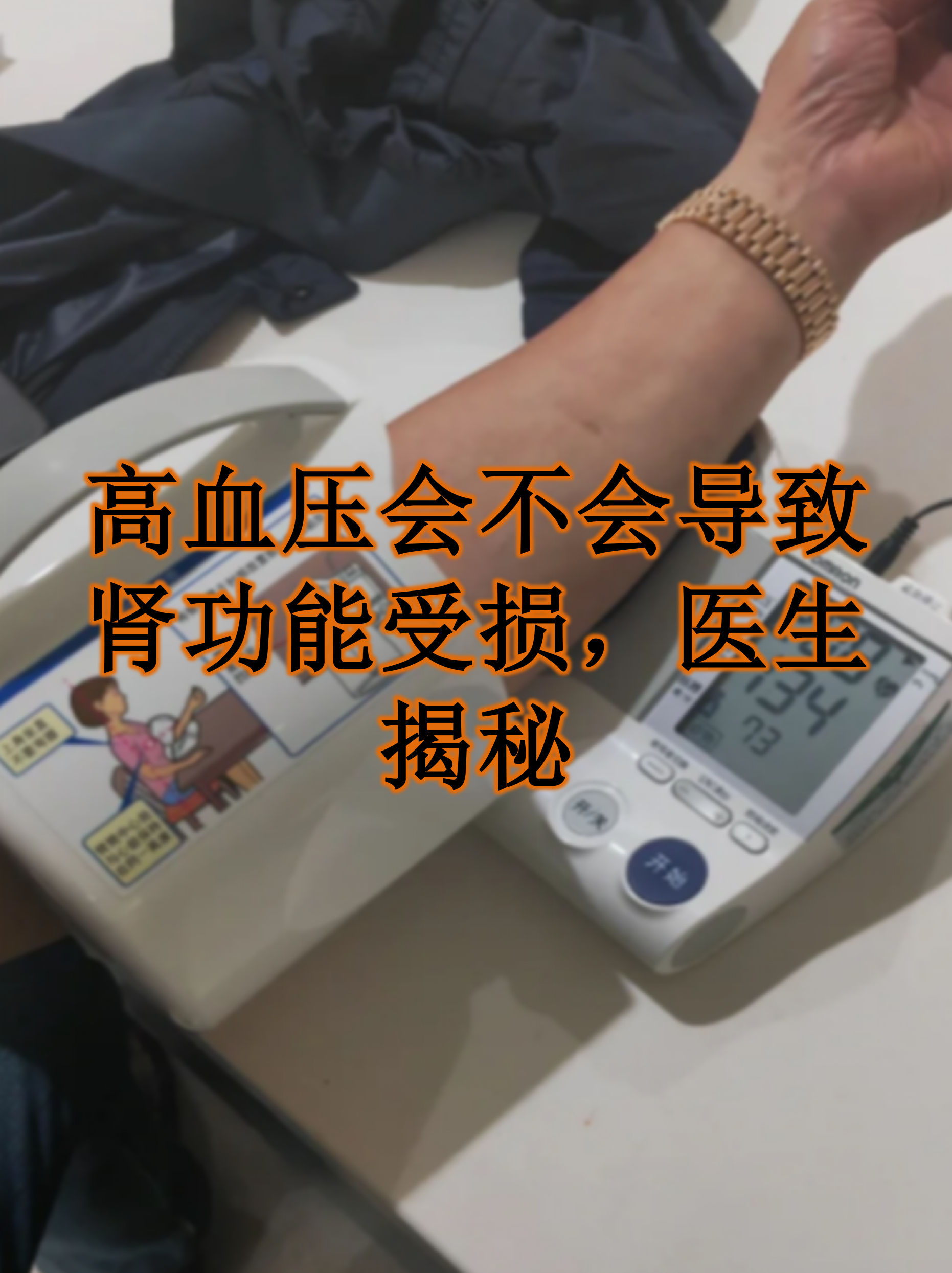 肾动脉狭窄高血压的特征