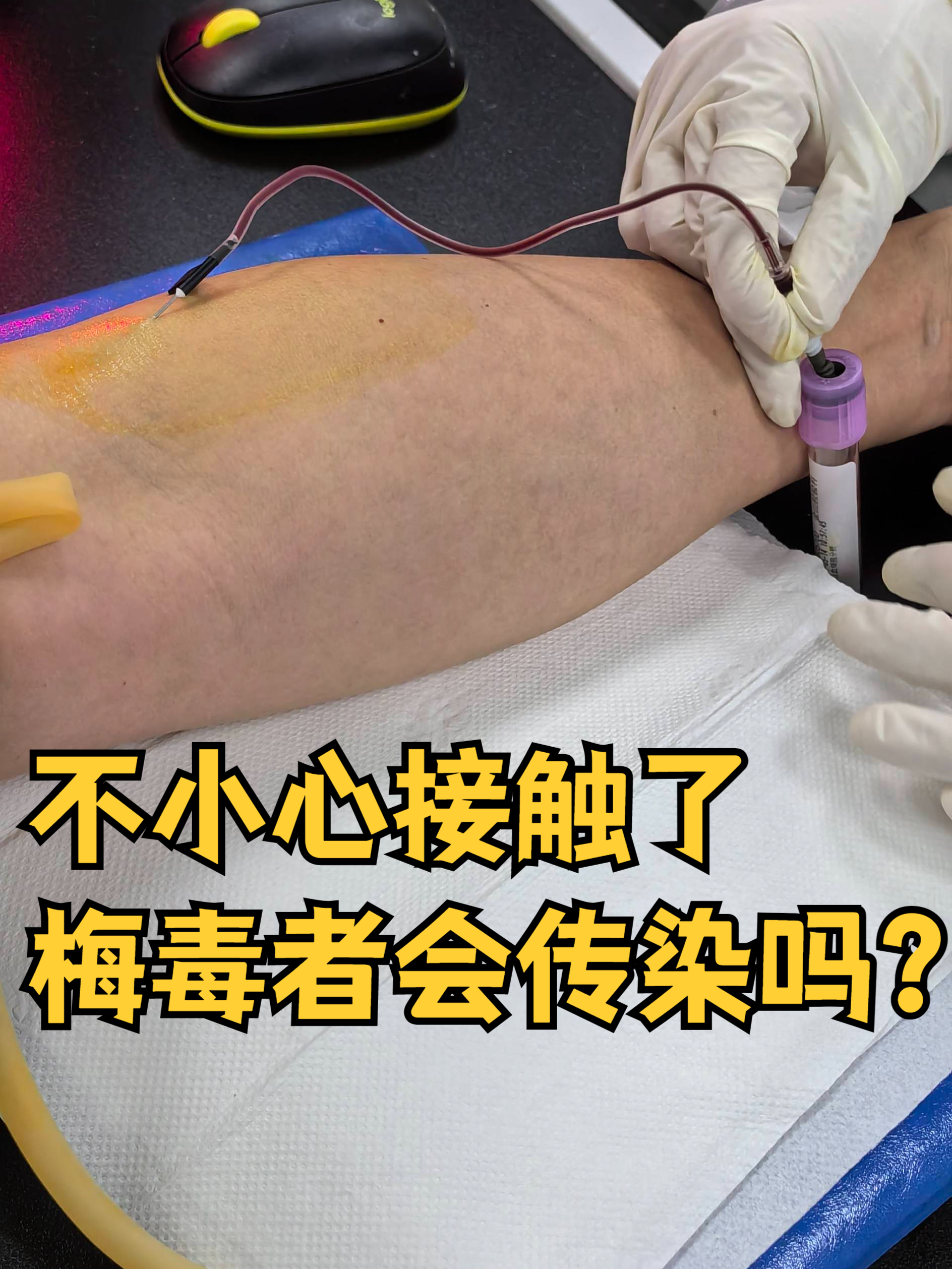和梅毒患者一起吃饭会被传染吗.