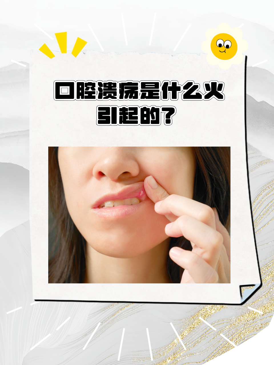 口腔溃疡,是因为上火吗