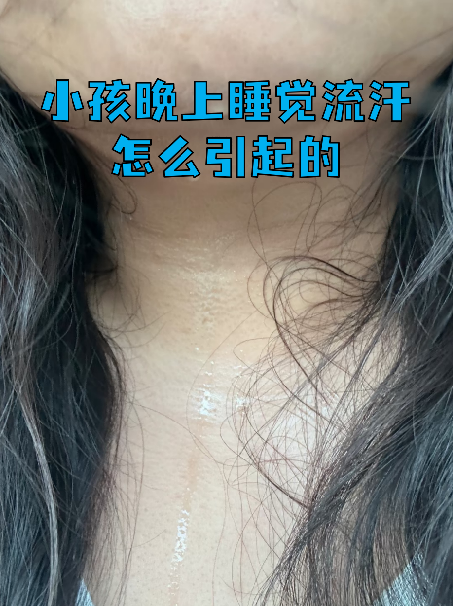 晚上睡觉出汗怎么治