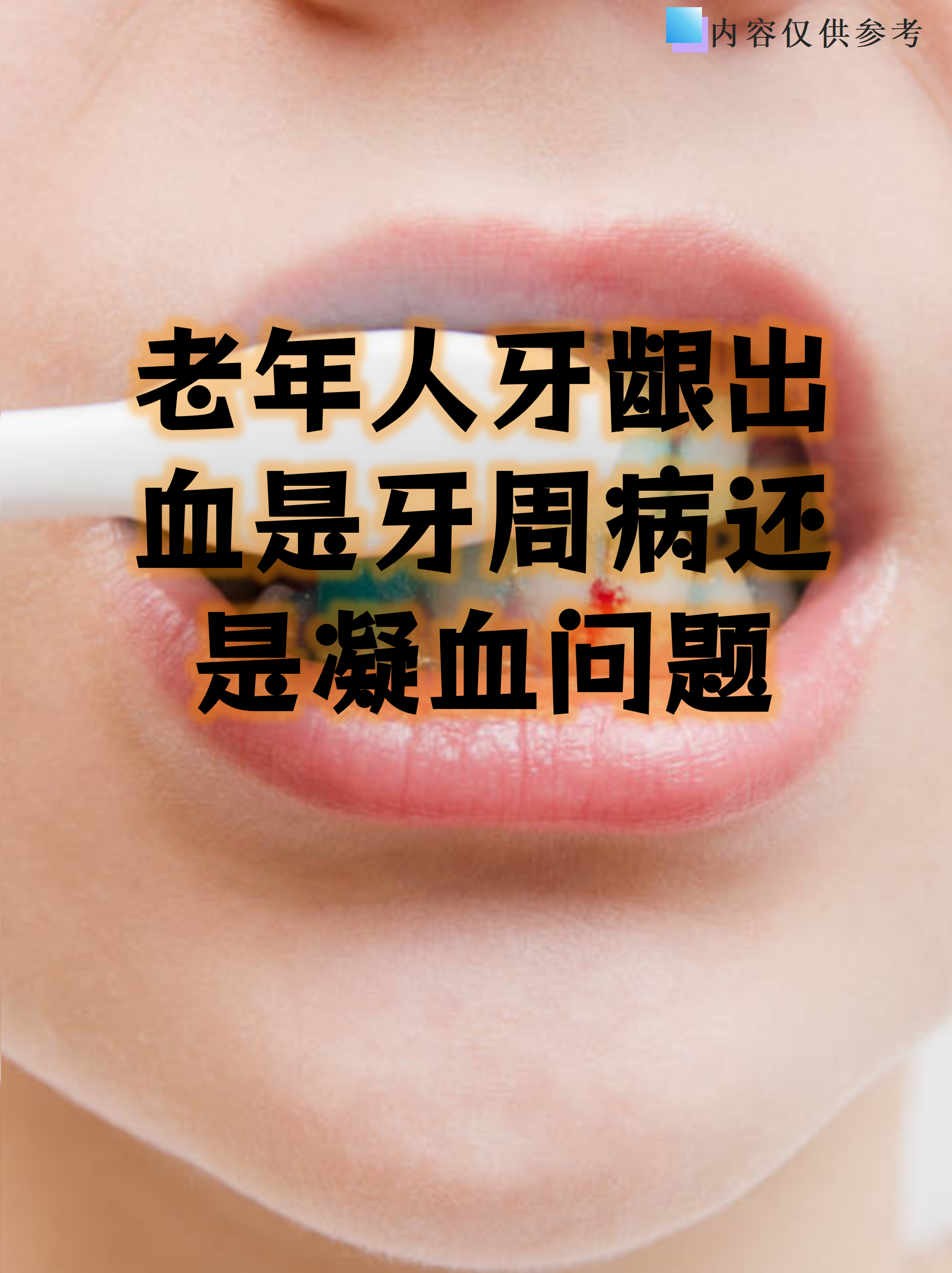 刷牙出血是什么原因六