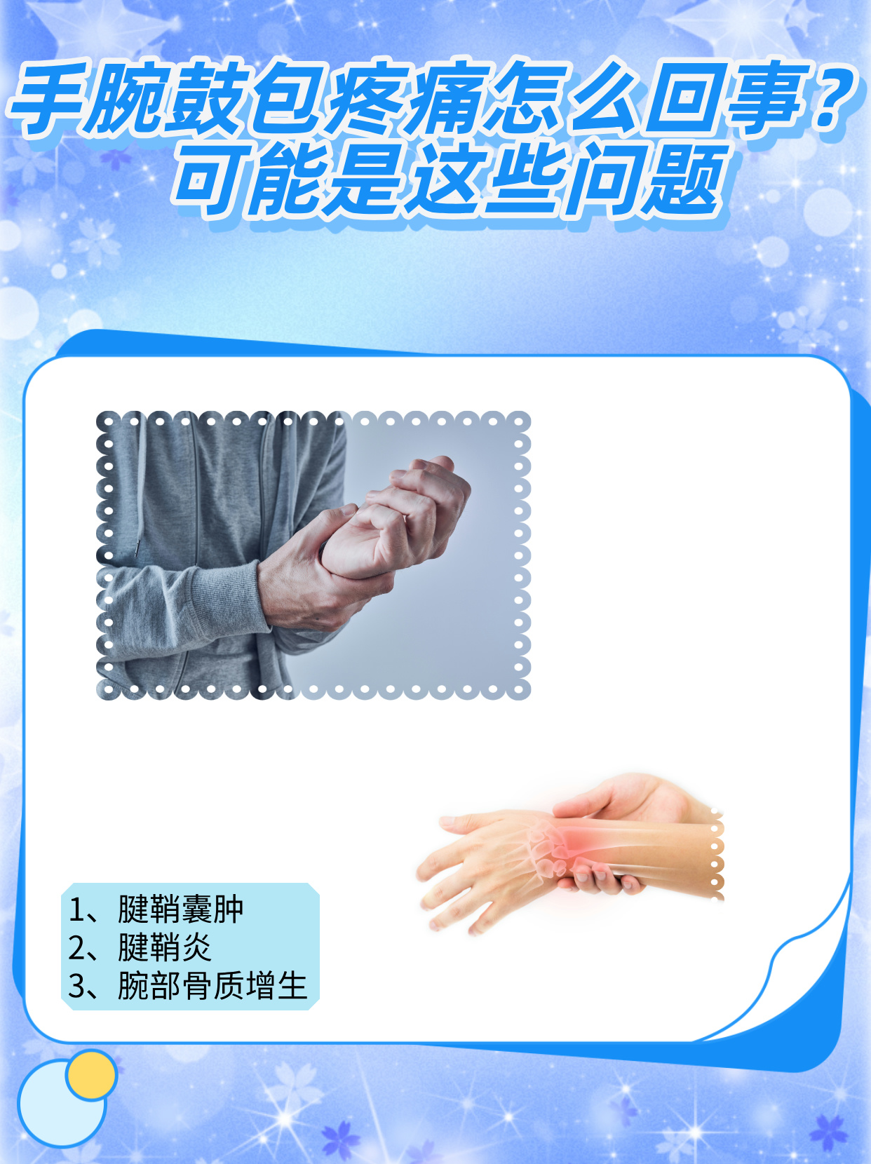 手腕关节疼痛是怎么回事?