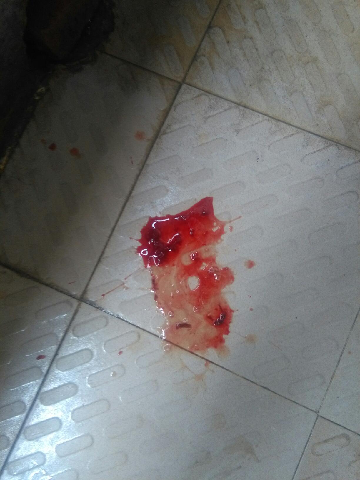 怀孕吐血正常吗?