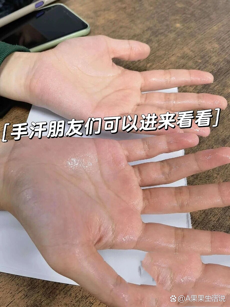 宝宝手心脚心出汗怎么回事?