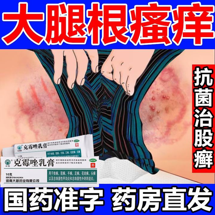 请问股藓用什么药膏有效