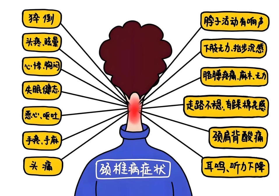 颈肩痛就一定是颈椎病吗