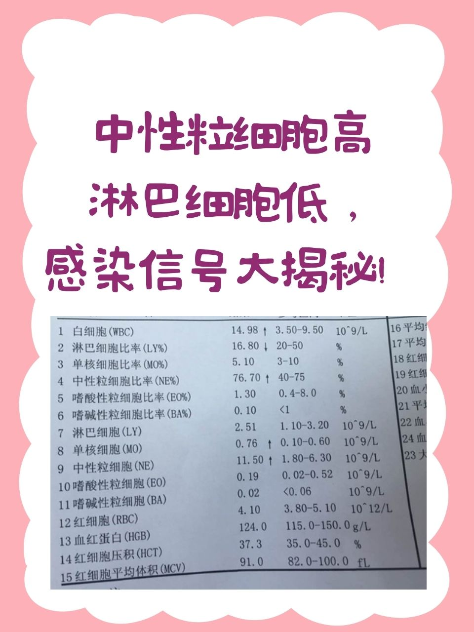 嗜酸性粒细胞百分比偏低怎么办