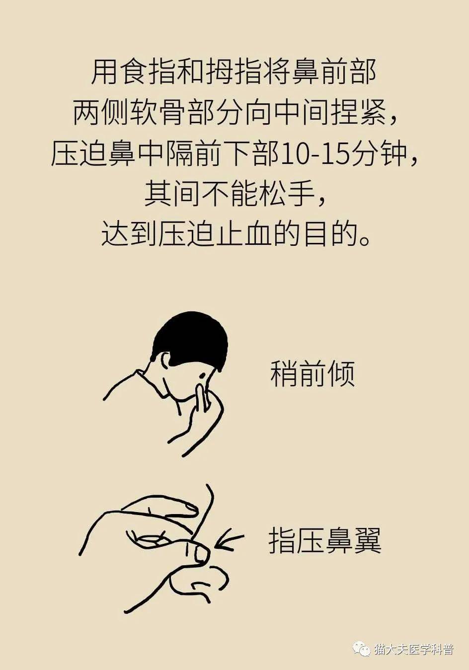鼻出血止血的方法都有哪些