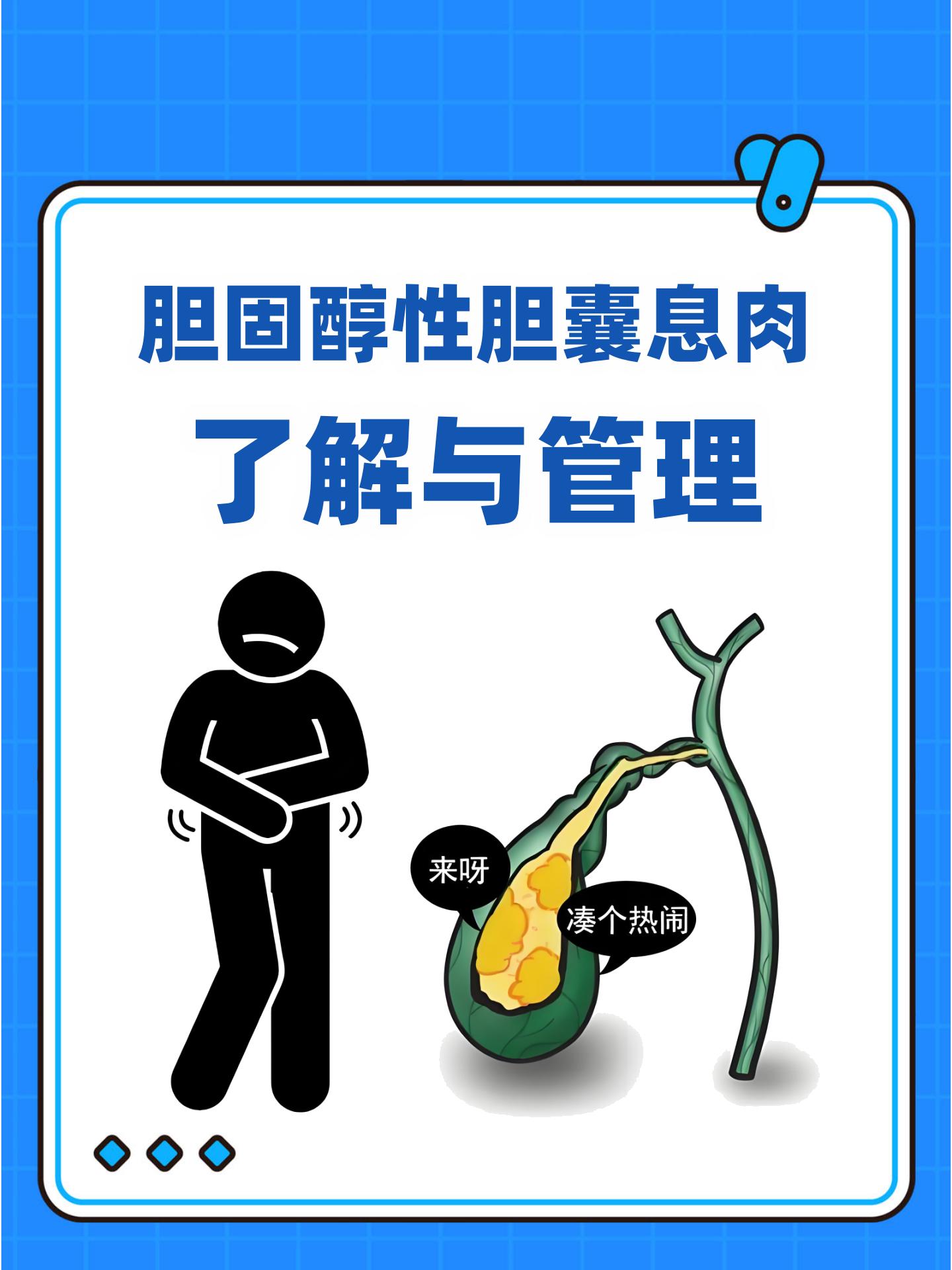 胆息肉是什么原因引起的?