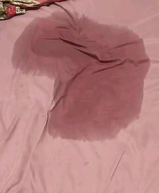 大人尿床是怎么回事