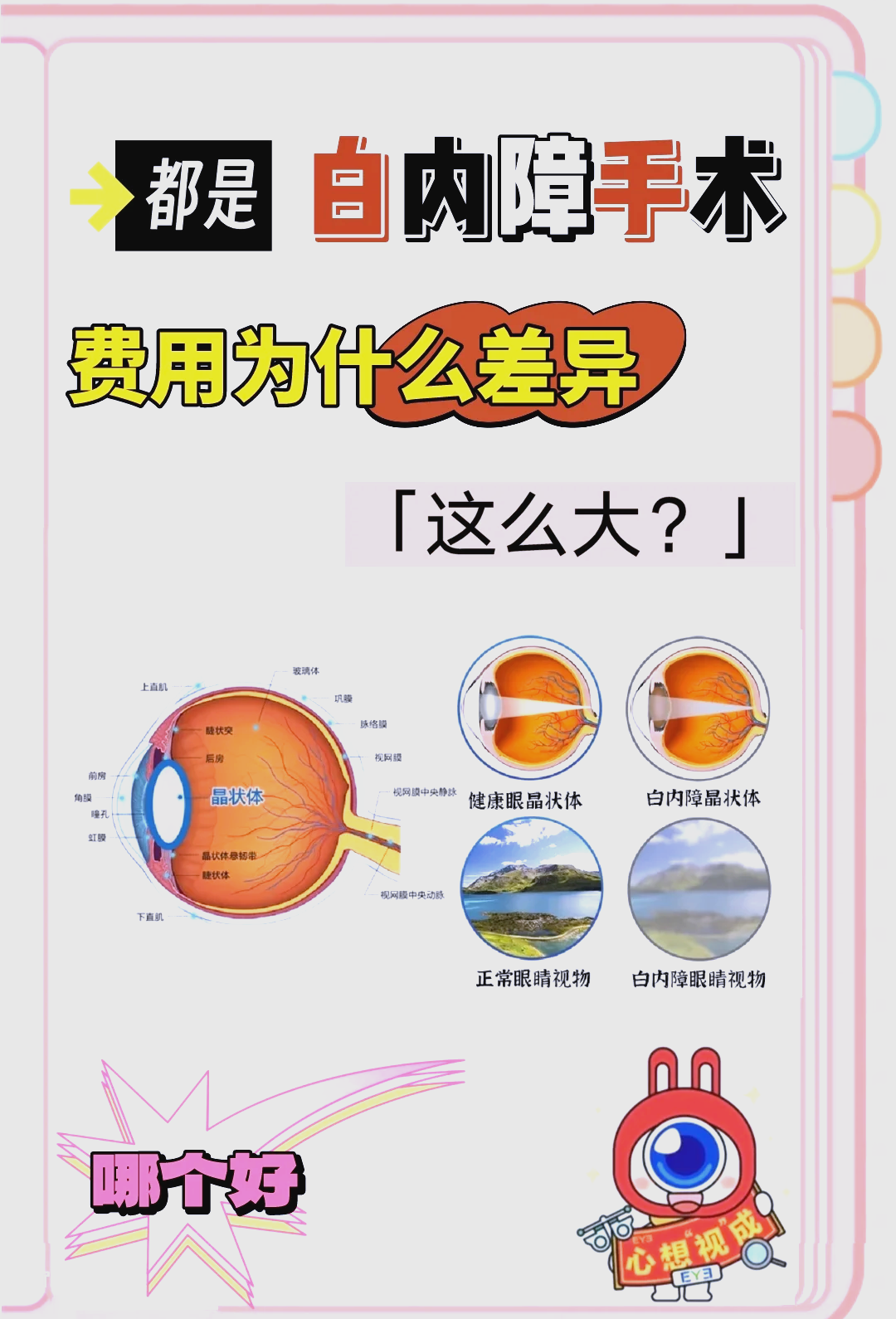 视网膜脱落手术费用是多少？