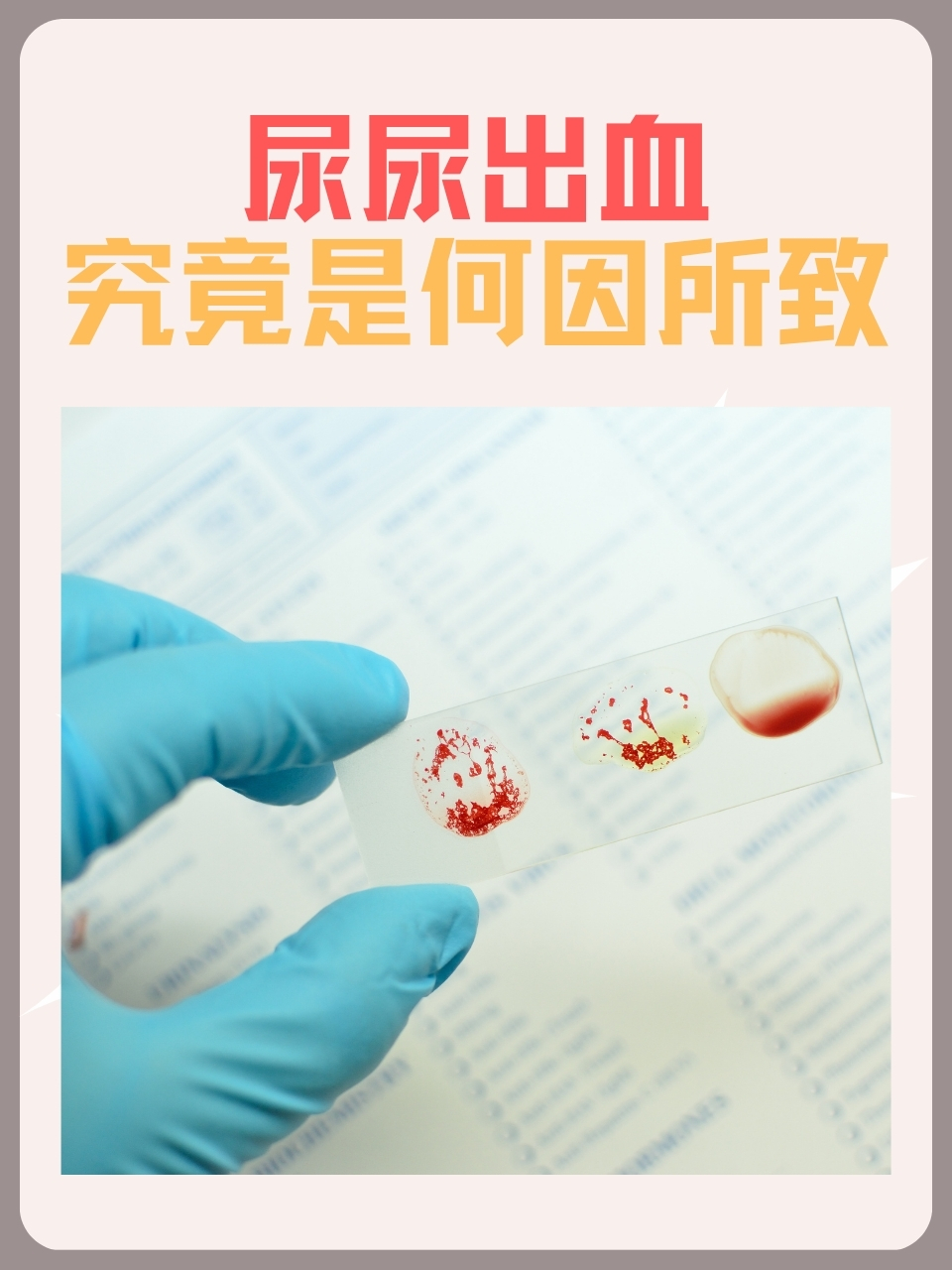 尿尿出血怎么回事