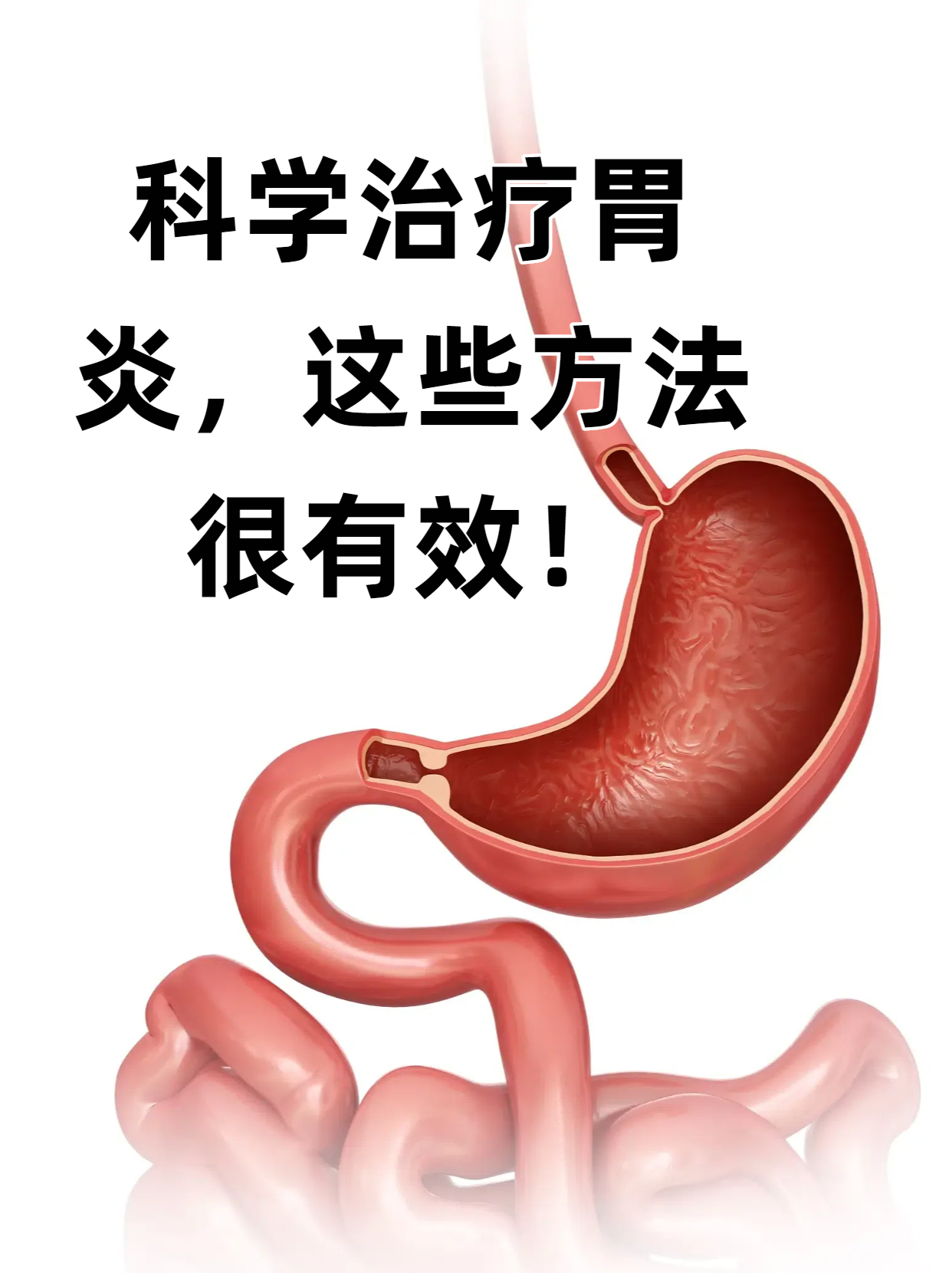 治疗胃炎的方法有哪些