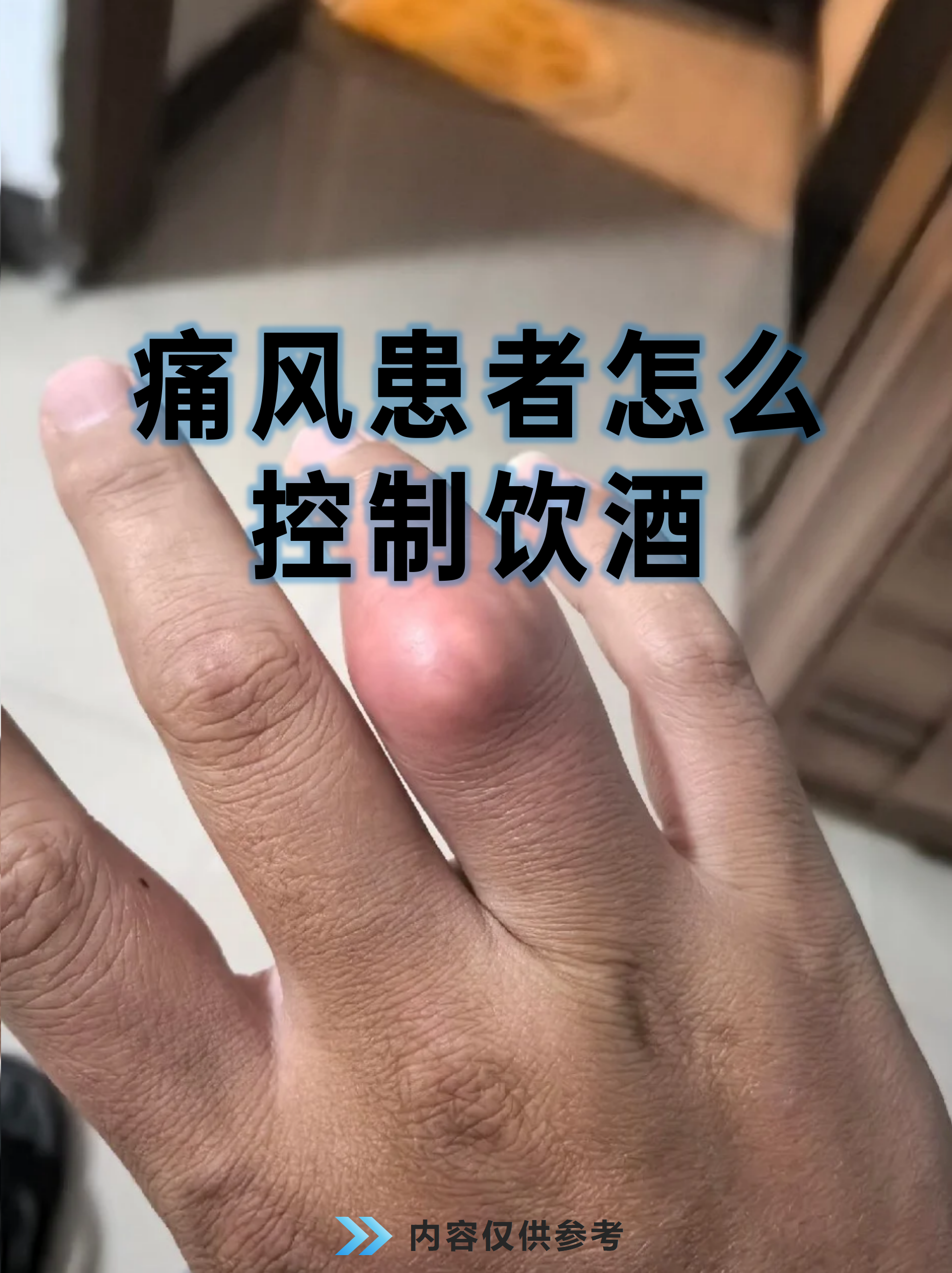 痛风可以喝白酒吗？