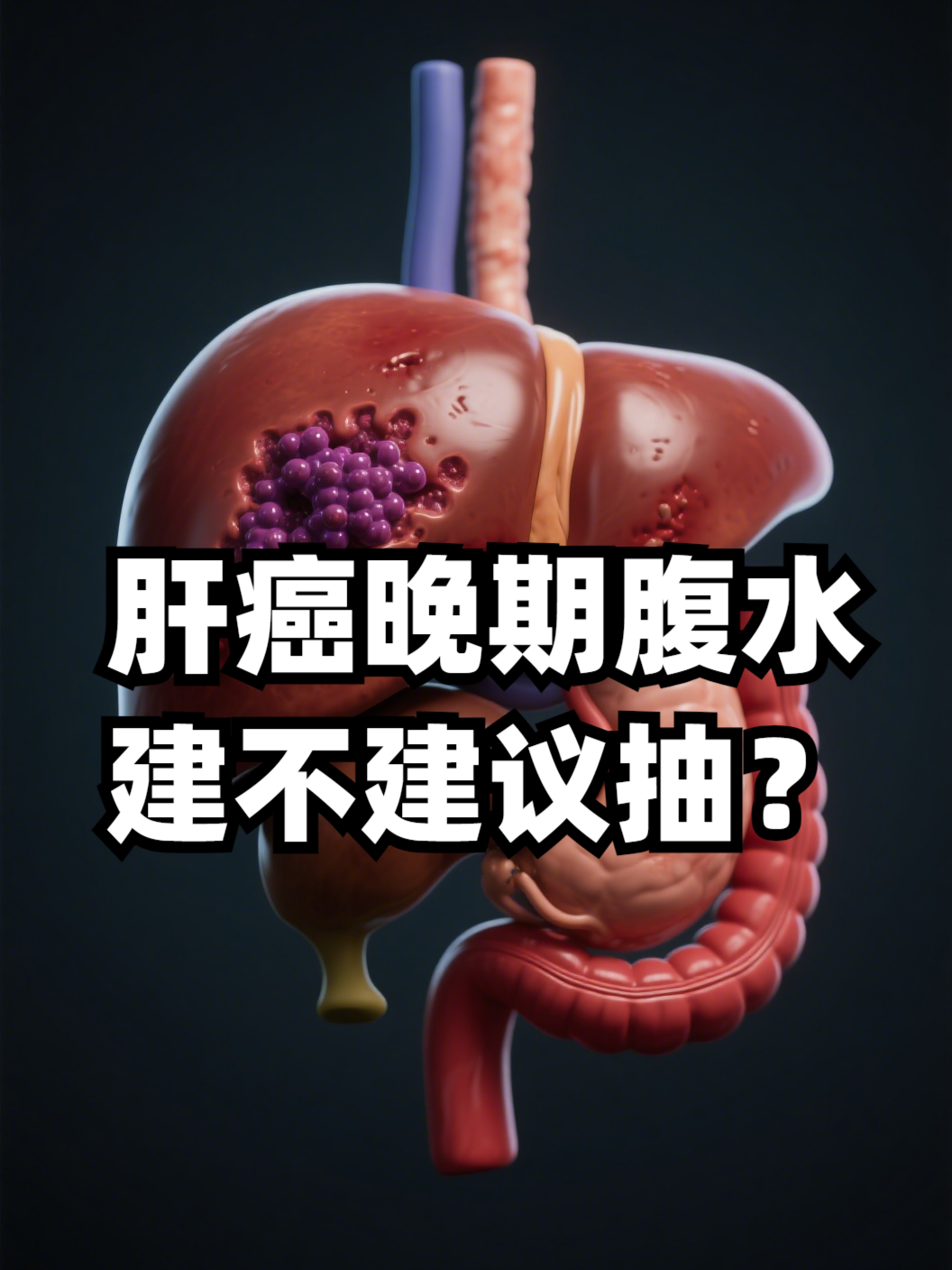 晚期肝癌能治吗