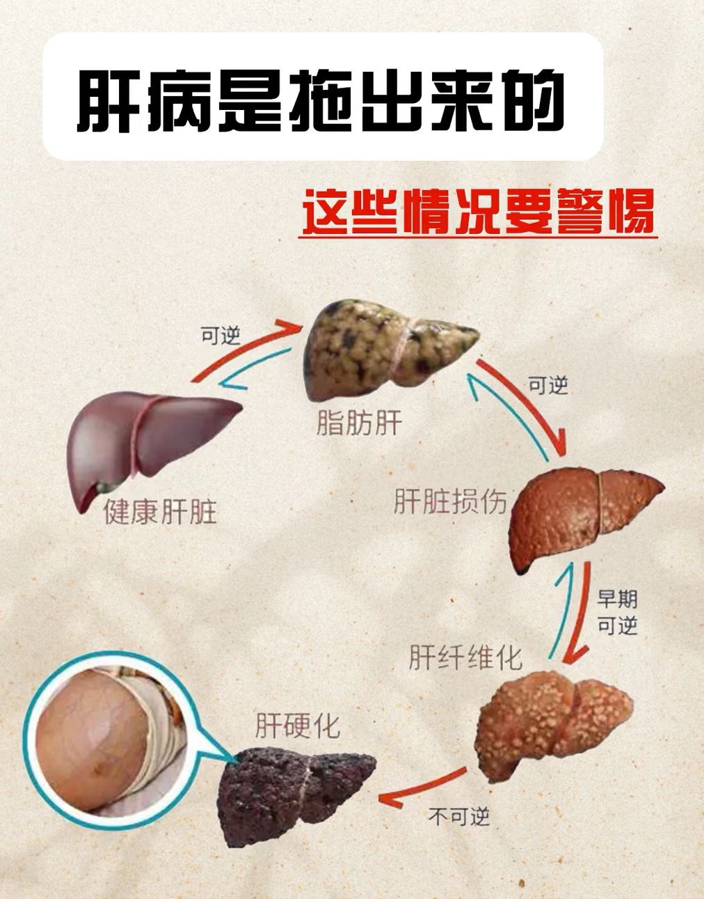 肝硬化和肝癌的区别是什么