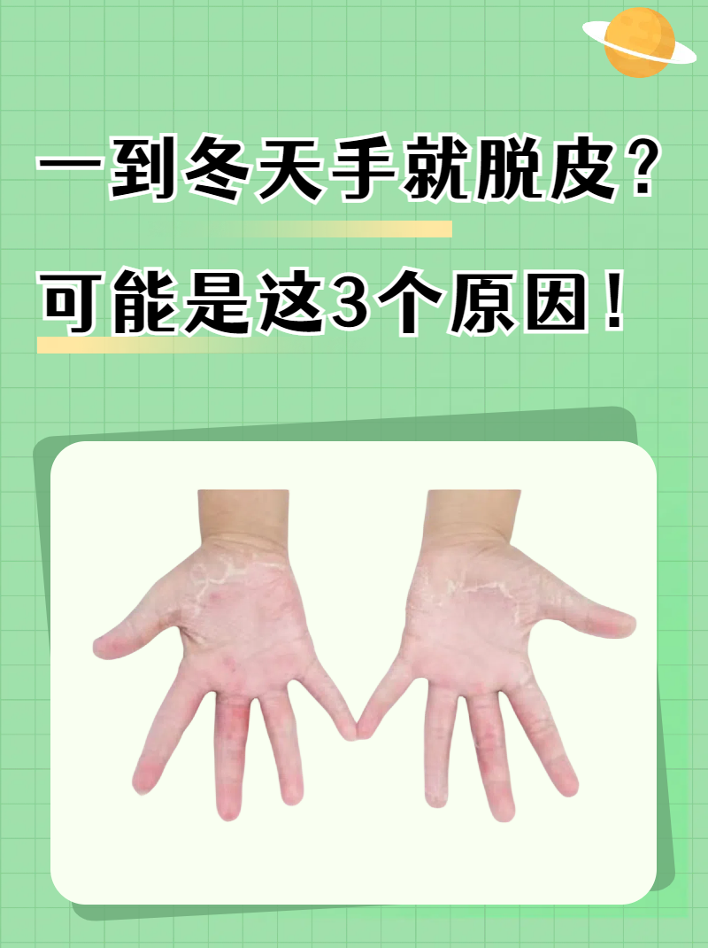 一到冬天手掌蜕皮怎么回事